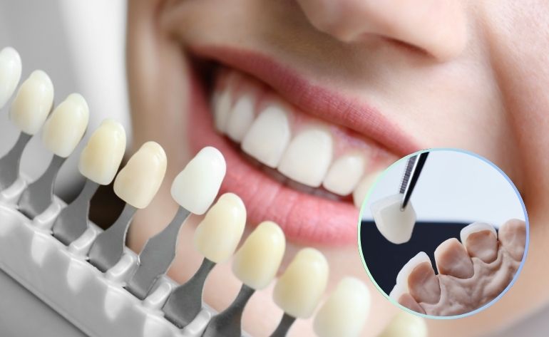 Everything You Need to Know Before Your Cosmetic Dental Surgery